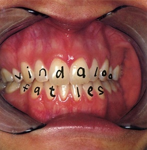 Vindaloo [CD 2] [CD 2]